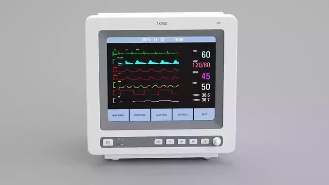ECG Monitor