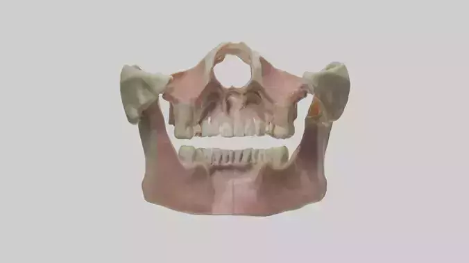 Human Maxilla Model