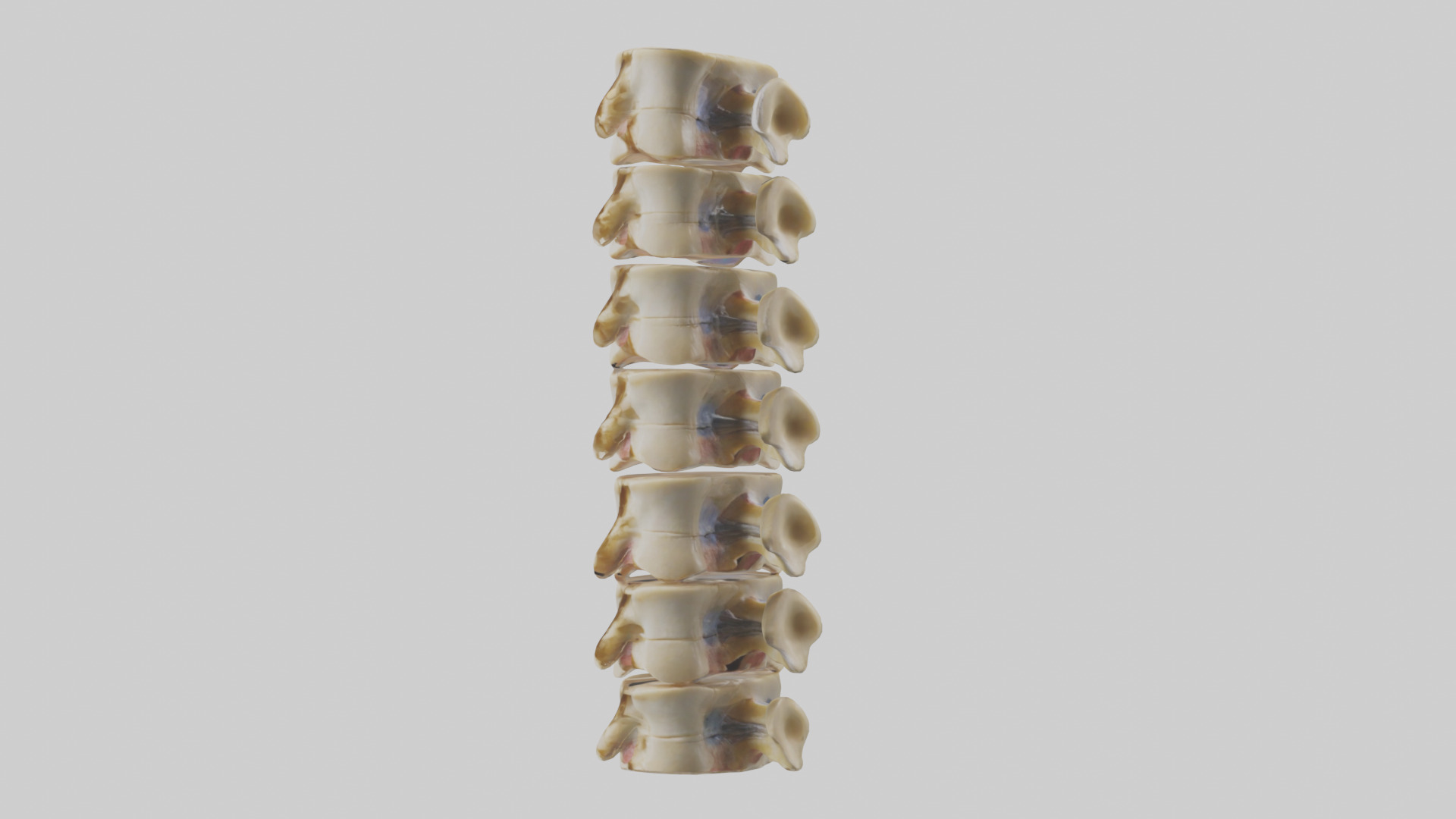 Human Vertebrae and Disc Model Low-poly 3D model_10