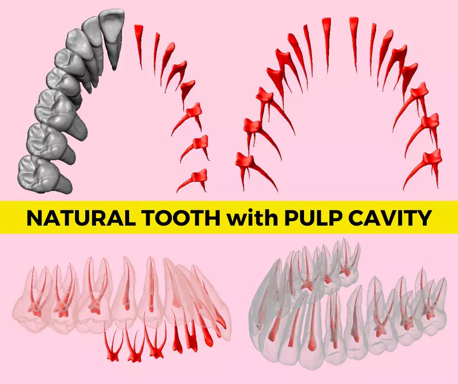 Natural teeth with pulp cavity upper maxillary 3D print model_0