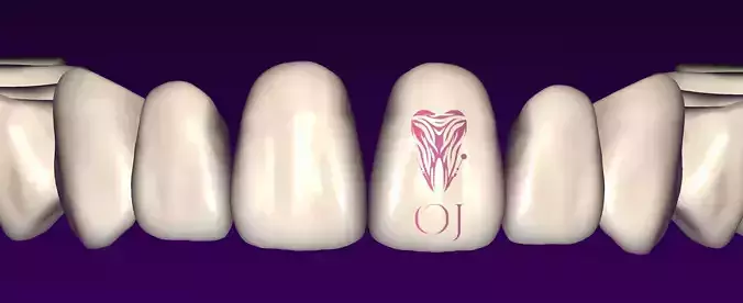 OJ RICK Exocad library