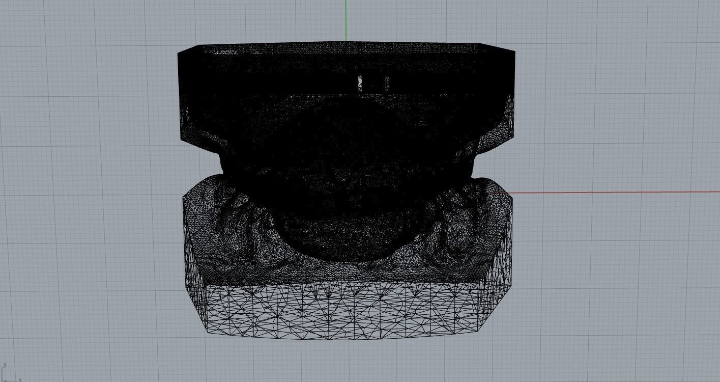 Digital Dental Bleaching Tray 3D print model_1