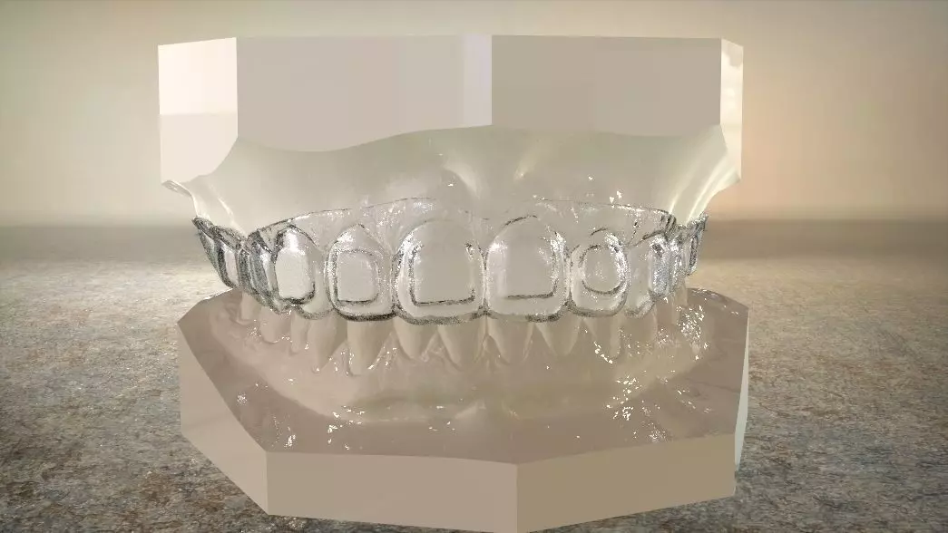 Digital Dental Bleaching Tray 3D print model_0