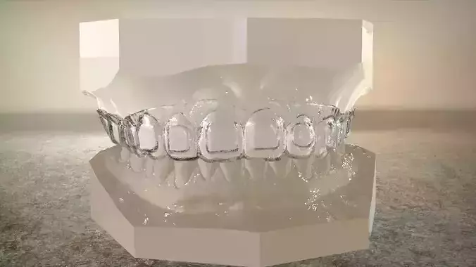 Digital Dental Bleaching Tray 3D print model