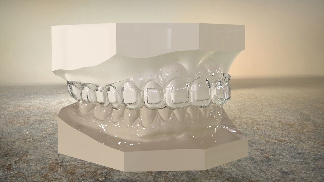 Digital Dental Bleaching Tray 3D print model_4