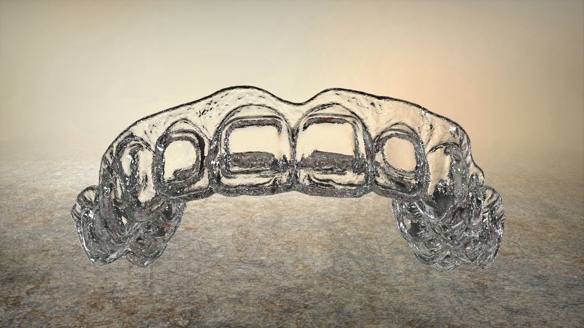 Digital Dental Bleaching Tray 3D print model_3