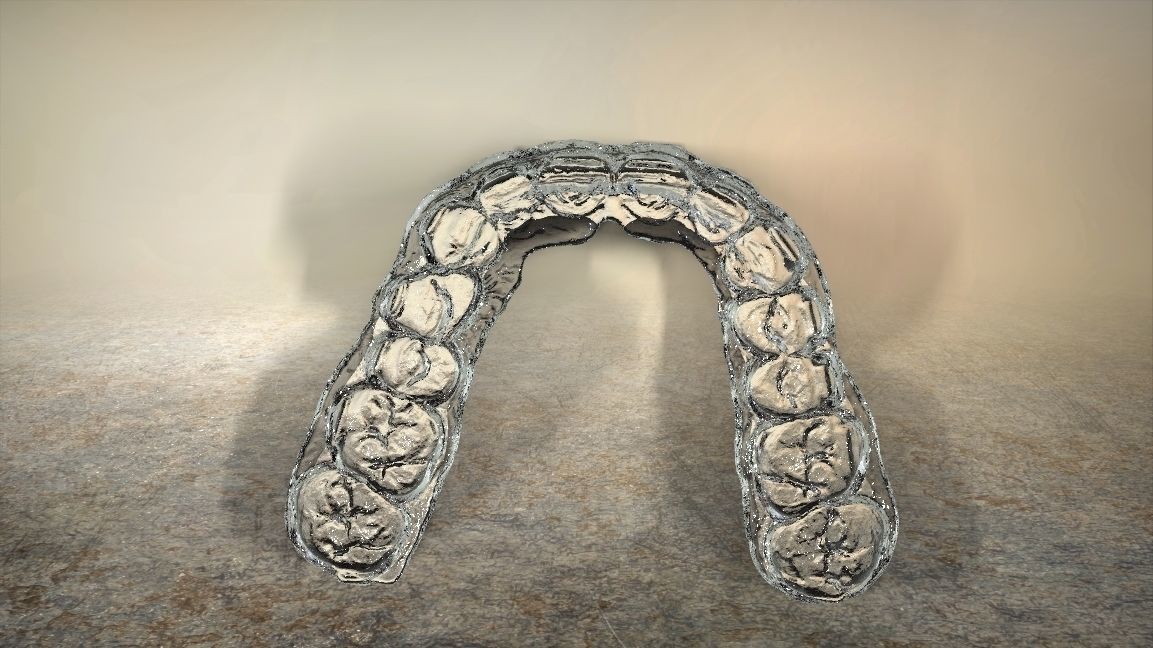 Digital Dental Bleaching Tray 3D print model_7