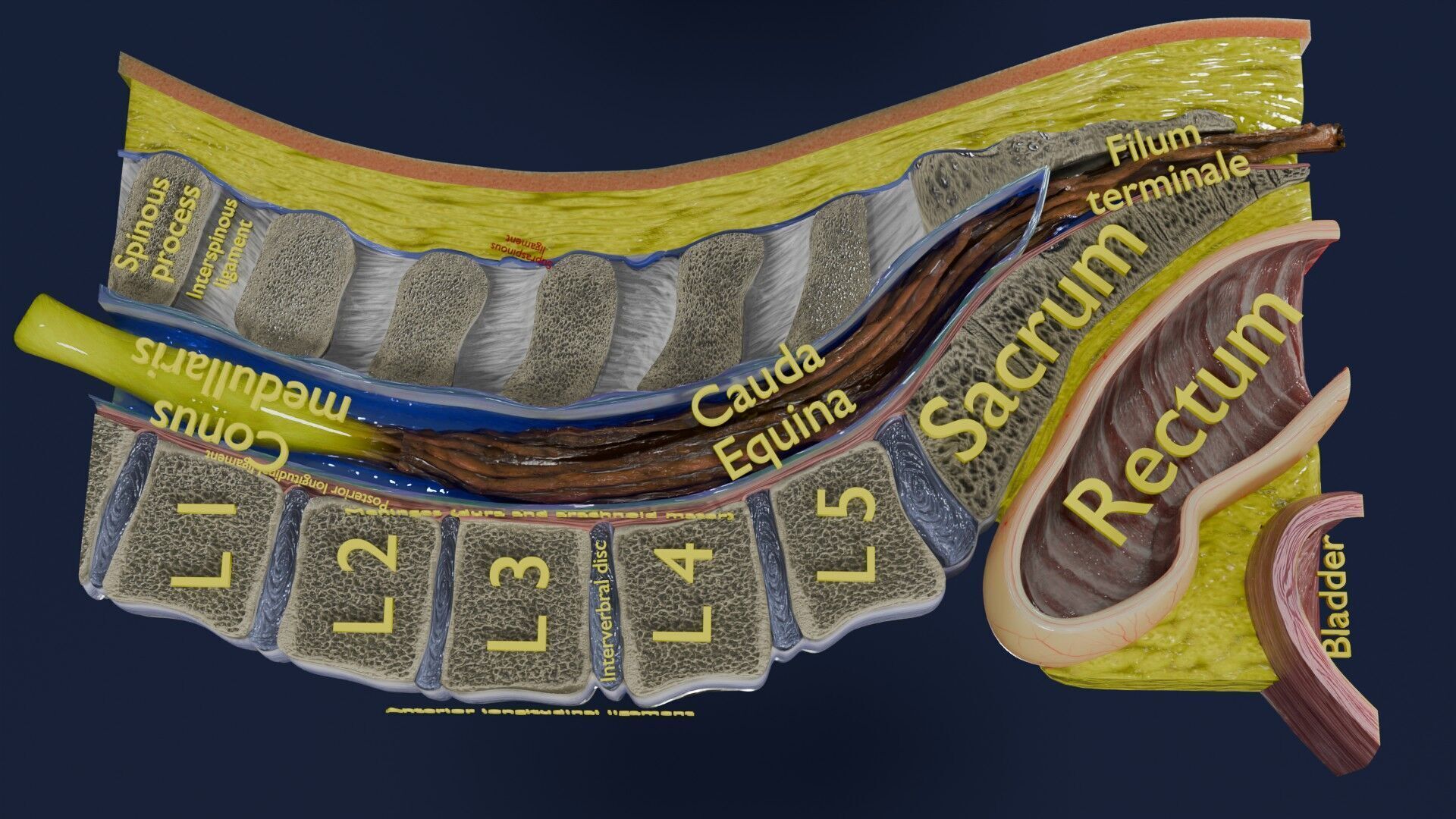Spina bifida Neural Tube Defect Low-poly 3D model_11
