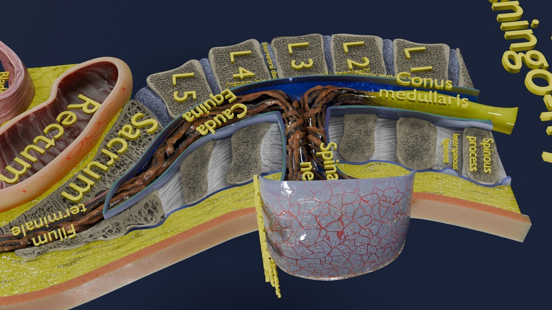 Spina bifida Neural Tube Defect Low-poly 3D model_67