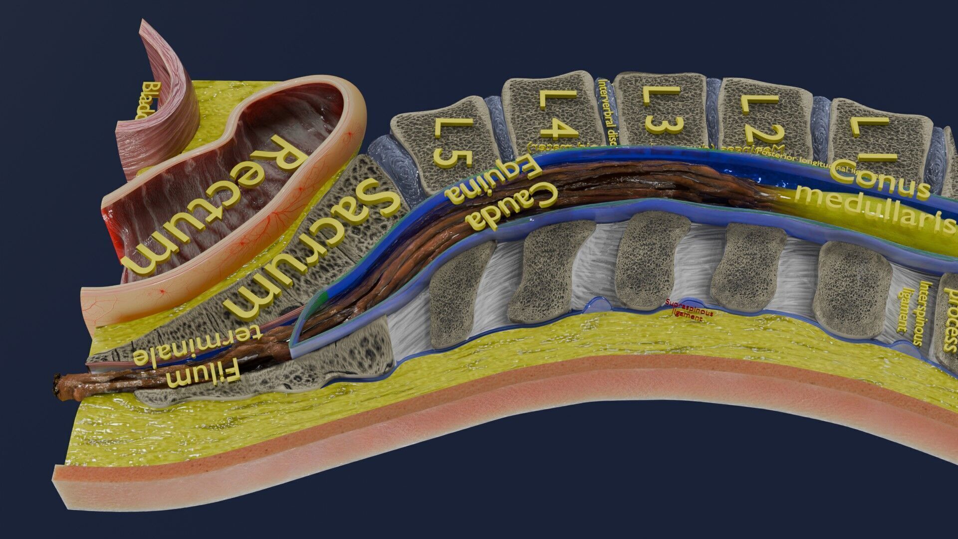 Spina bifida Neural Tube Defect Low-poly 3D model_20