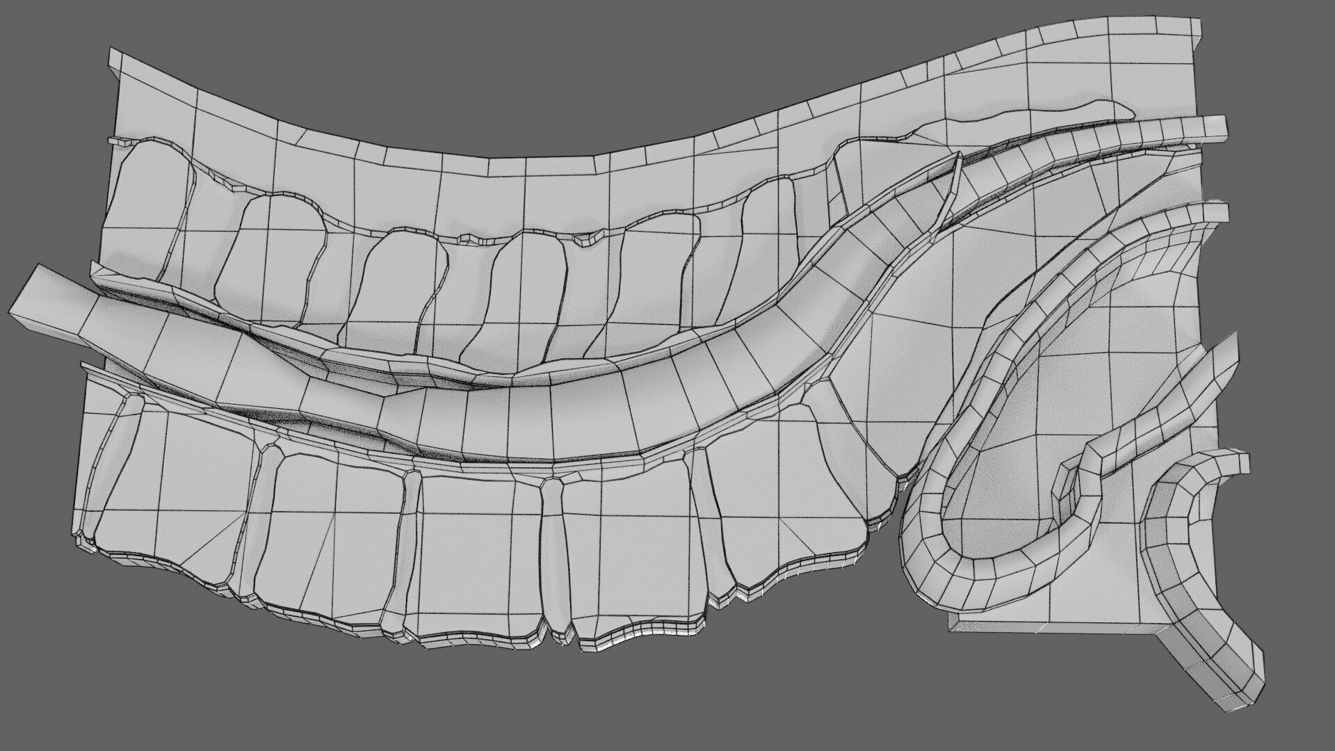 Spina bifida Neural Tube Defect Low-poly 3D model_100