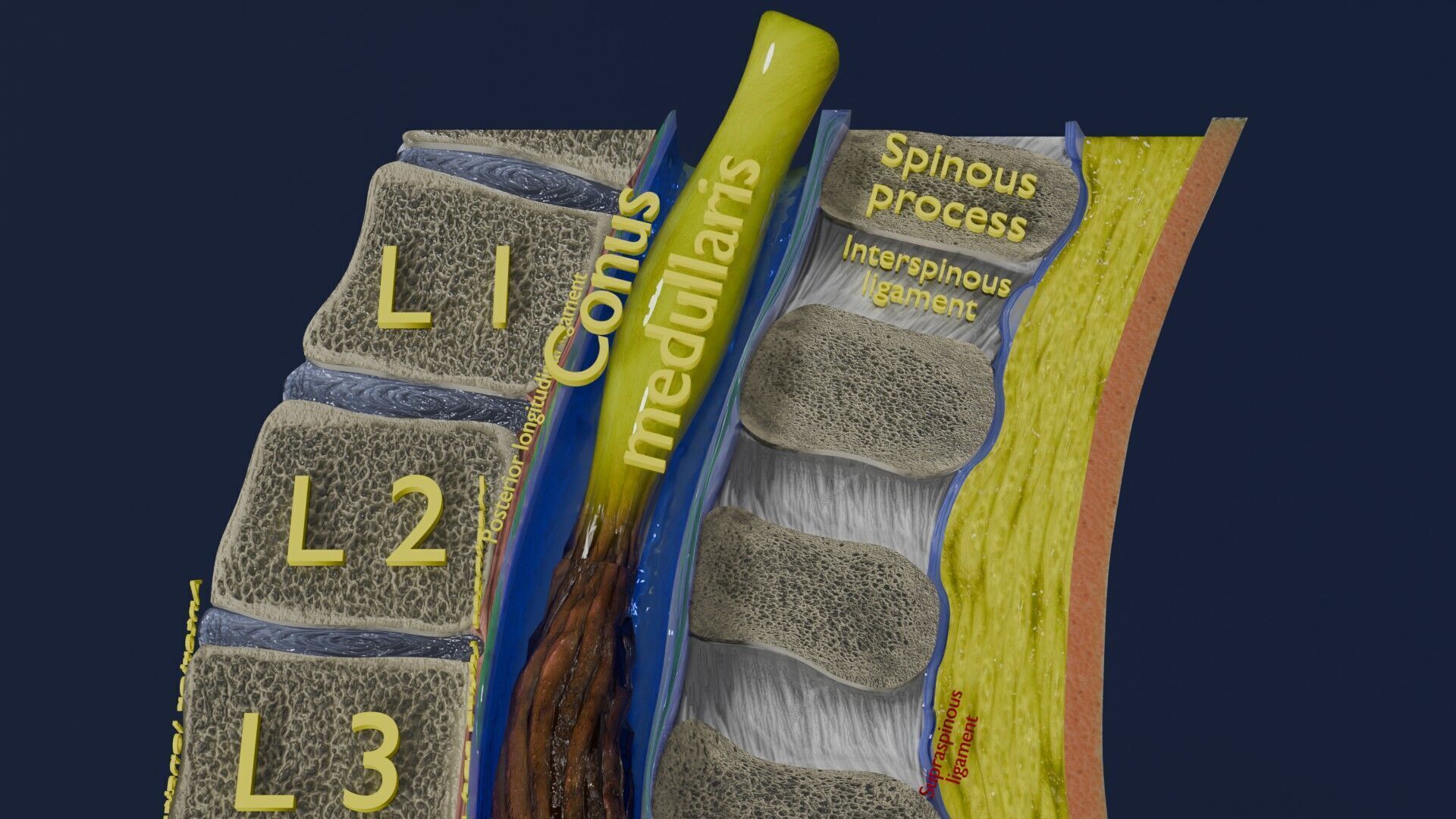 Spina bifida Neural Tube Defect Low-poly 3D model_14