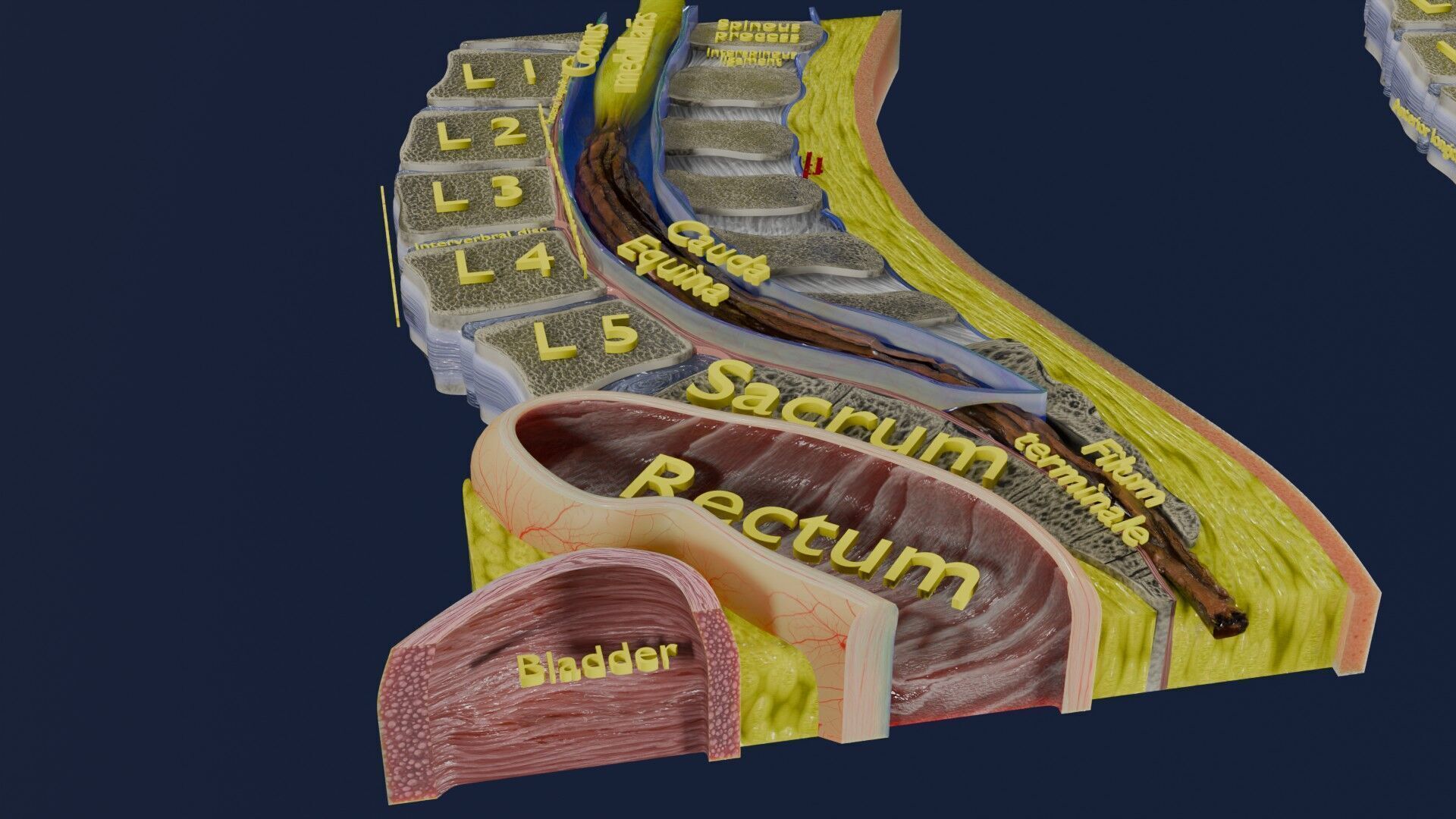 Spina bifida Neural Tube Defect Low-poly 3D model_15