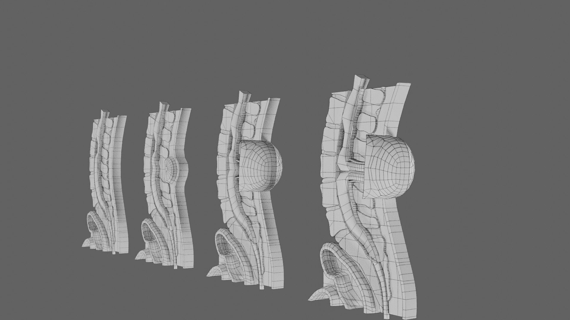 Spina bifida Neural Tube Defect Low-poly 3D model_77