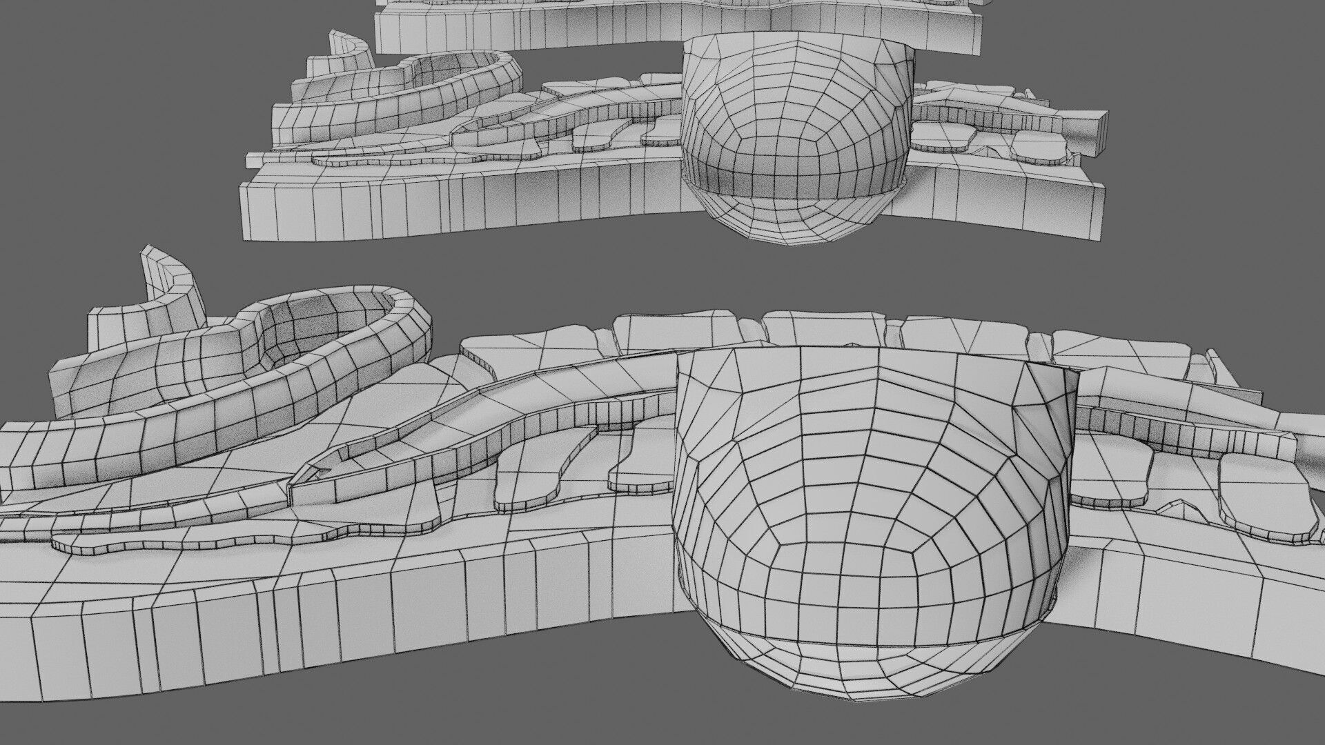 Spina bifida Neural Tube Defect Low-poly 3D model_94