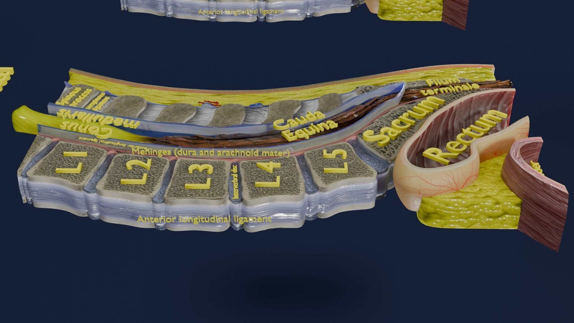 Spina bifida Neural Tube Defect Low-poly 3D model_7