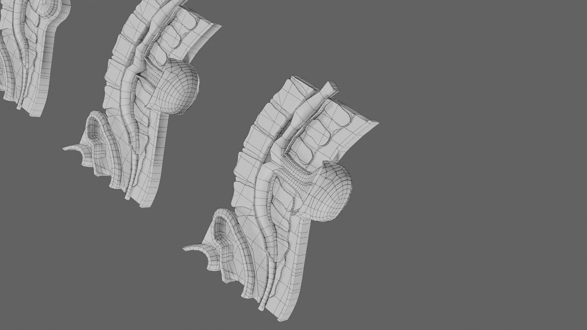 Spina bifida Neural Tube Defect Low-poly 3D model_84