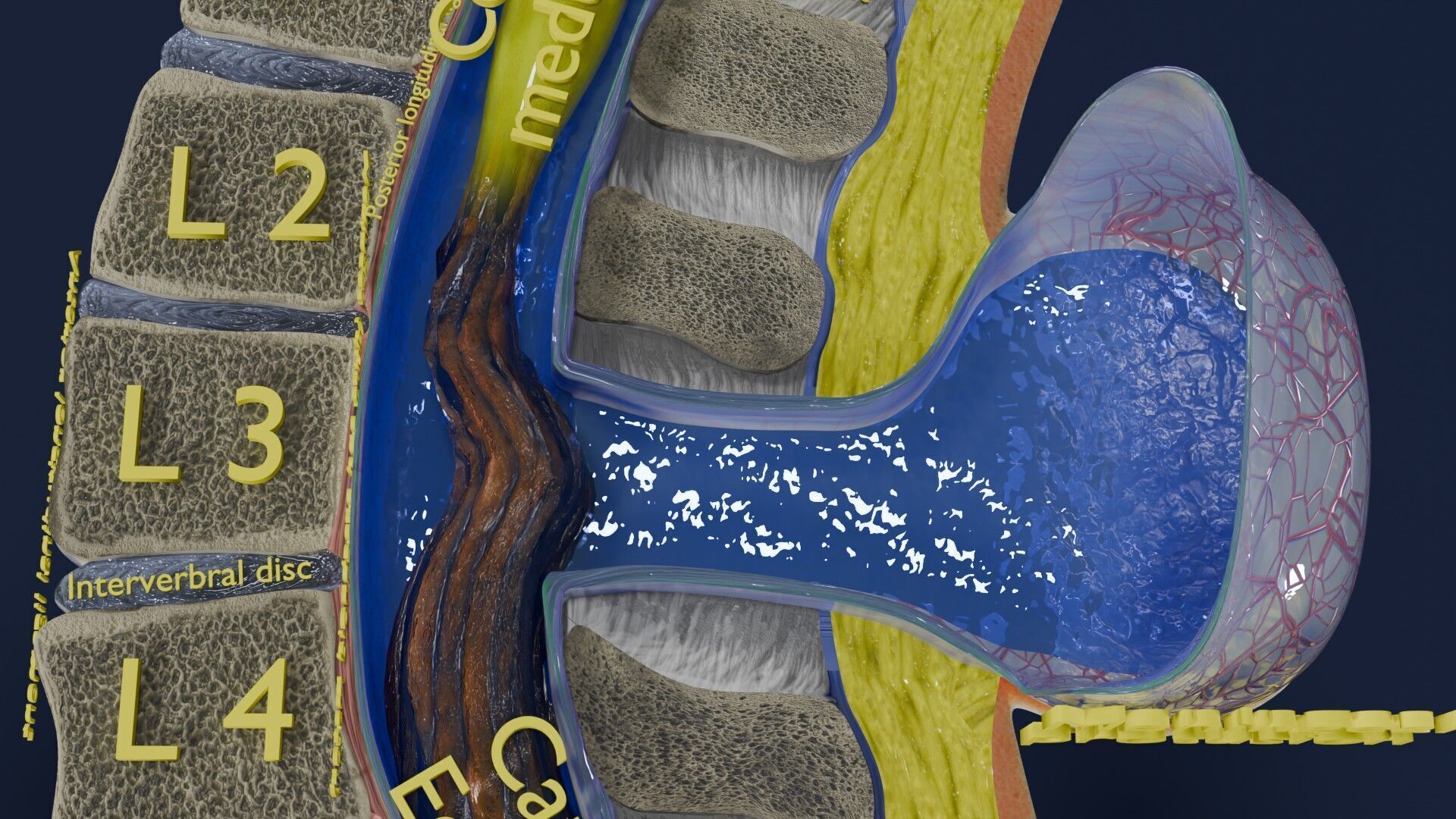 Spina bifida Neural Tube Defect Low-poly 3D model_41