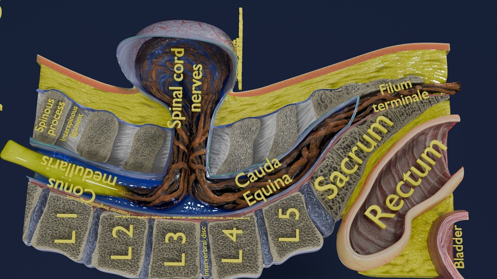 Spina bifida Neural Tube Defect Low-poly 3D model_70