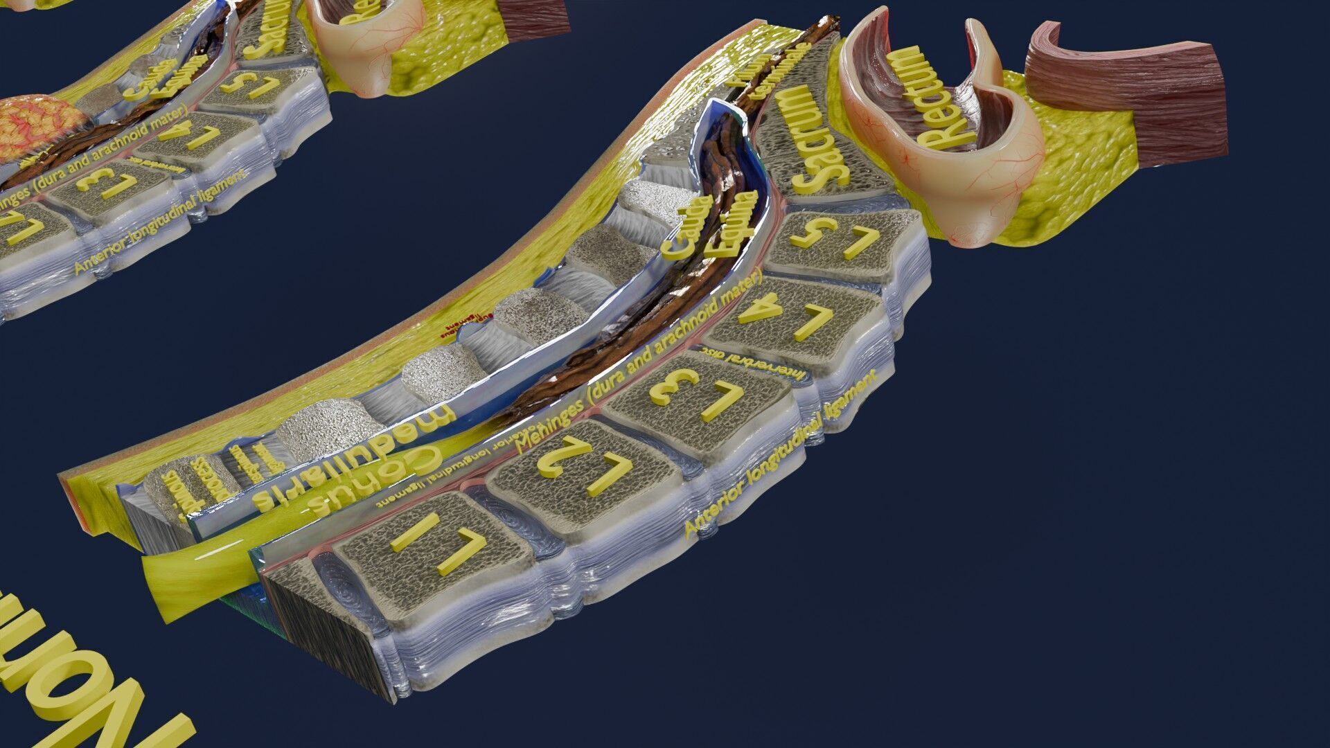 Spina bifida Neural Tube Defect Low-poly 3D model_12