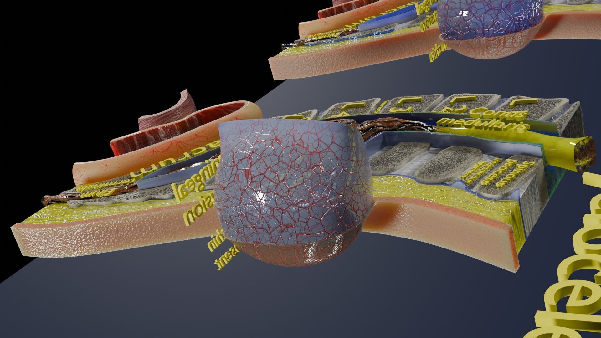 Spina bifida Neural Tube Defect Low-poly 3D model_68