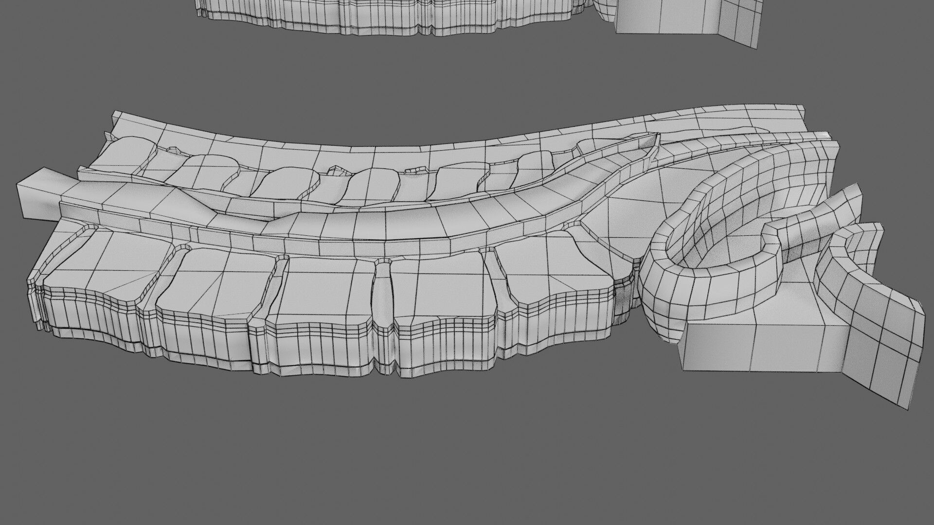 Spina bifida Neural Tube Defect Low-poly 3D model_83