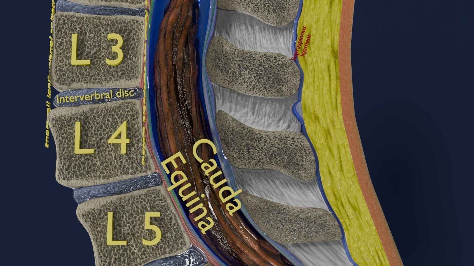 Spina bifida Neural Tube Defect Low-poly 3D model_18