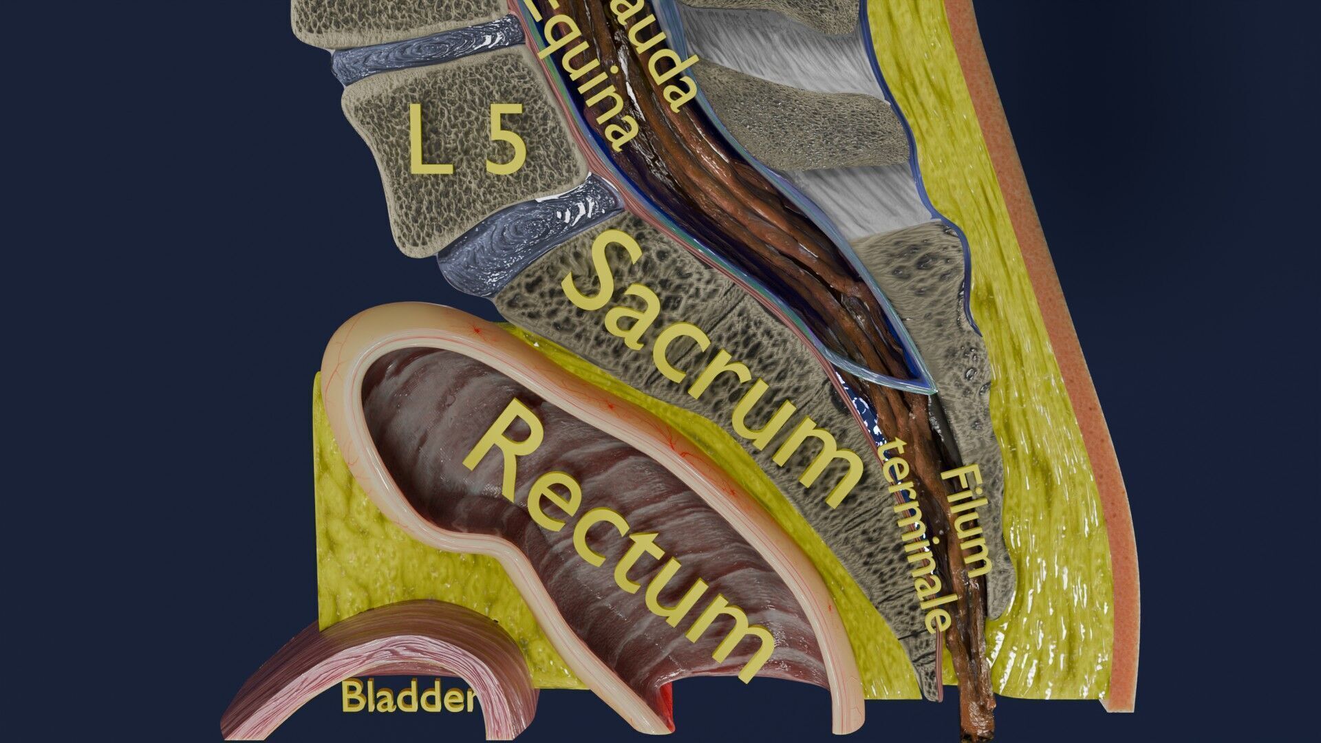 Spina bifida Neural Tube Defect Low-poly 3D model_19