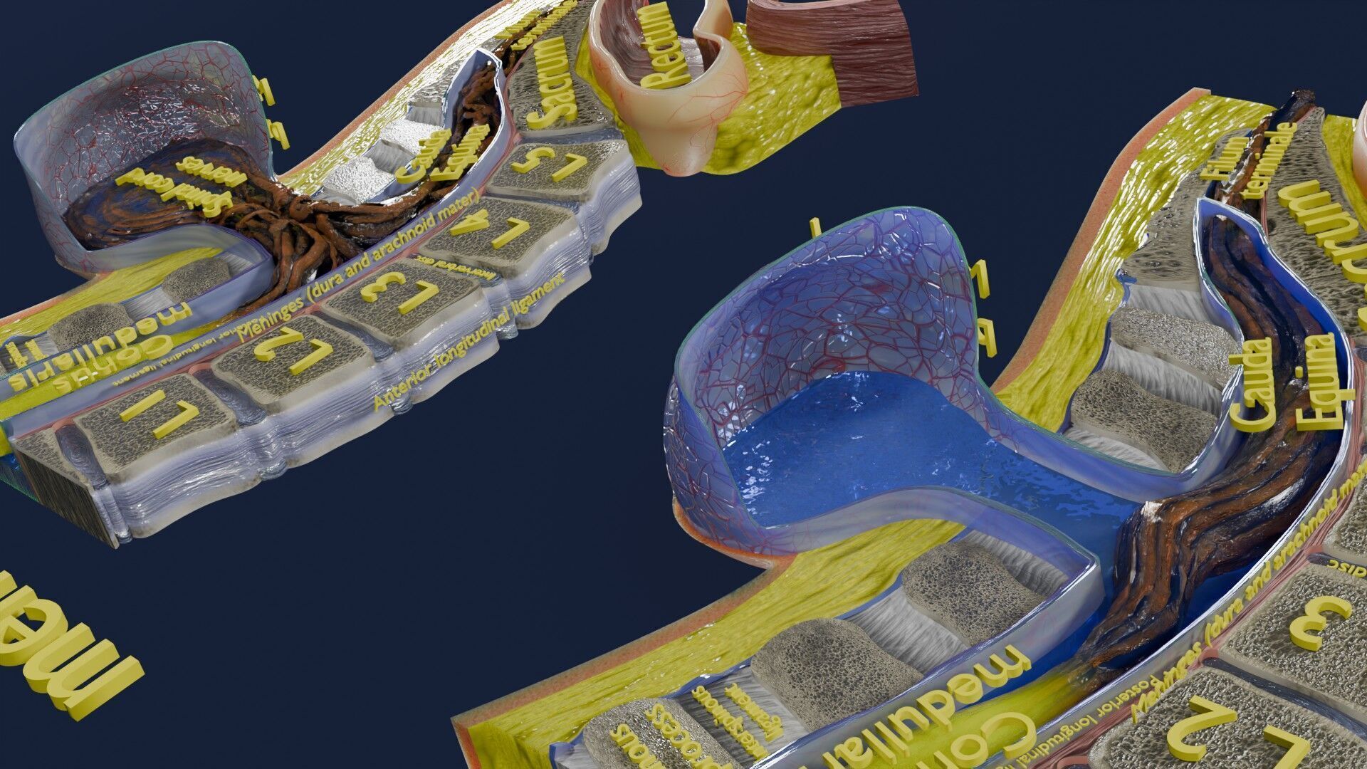 Spina bifida Neural Tube Defect Low-poly 3D model_73