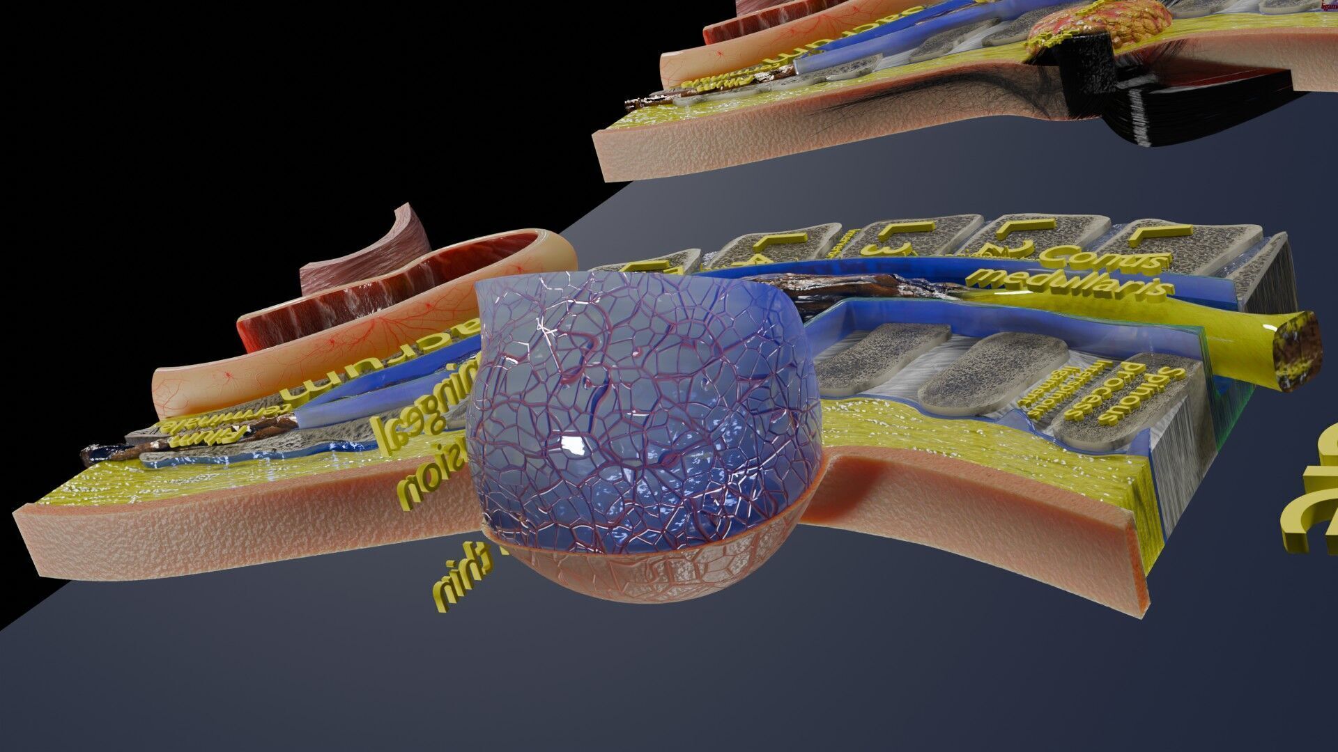 Spina bifida Neural Tube Defect Low-poly 3D model_66