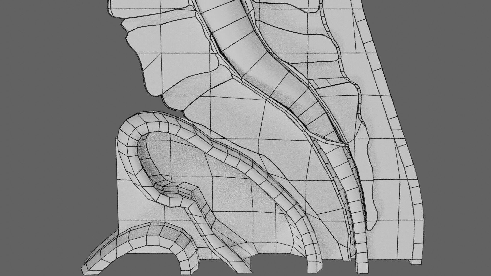 Spina bifida Neural Tube Defect Low-poly 3D model_99
