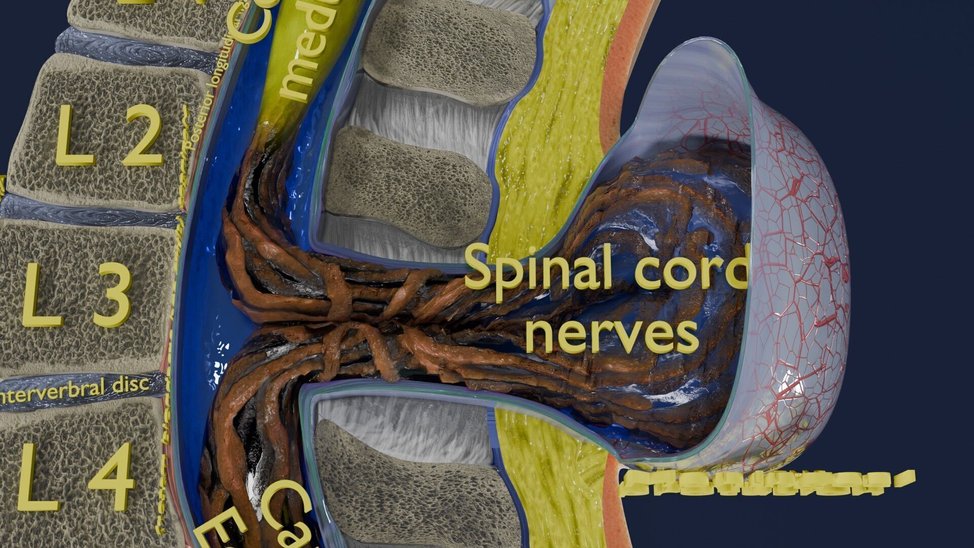 Spina bifida Neural Tube Defect Low-poly 3D model_51