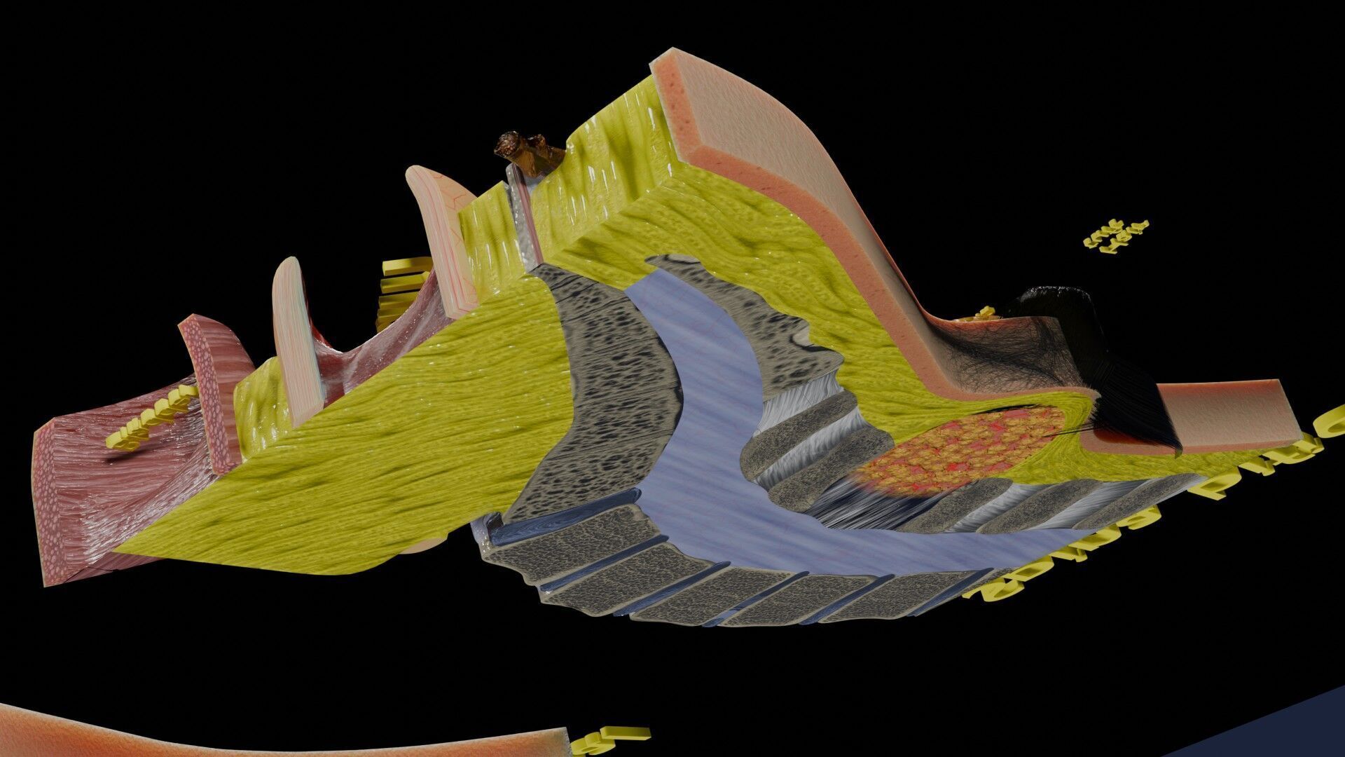 Spina bifida Neural Tube Defect Low-poly 3D model_38
