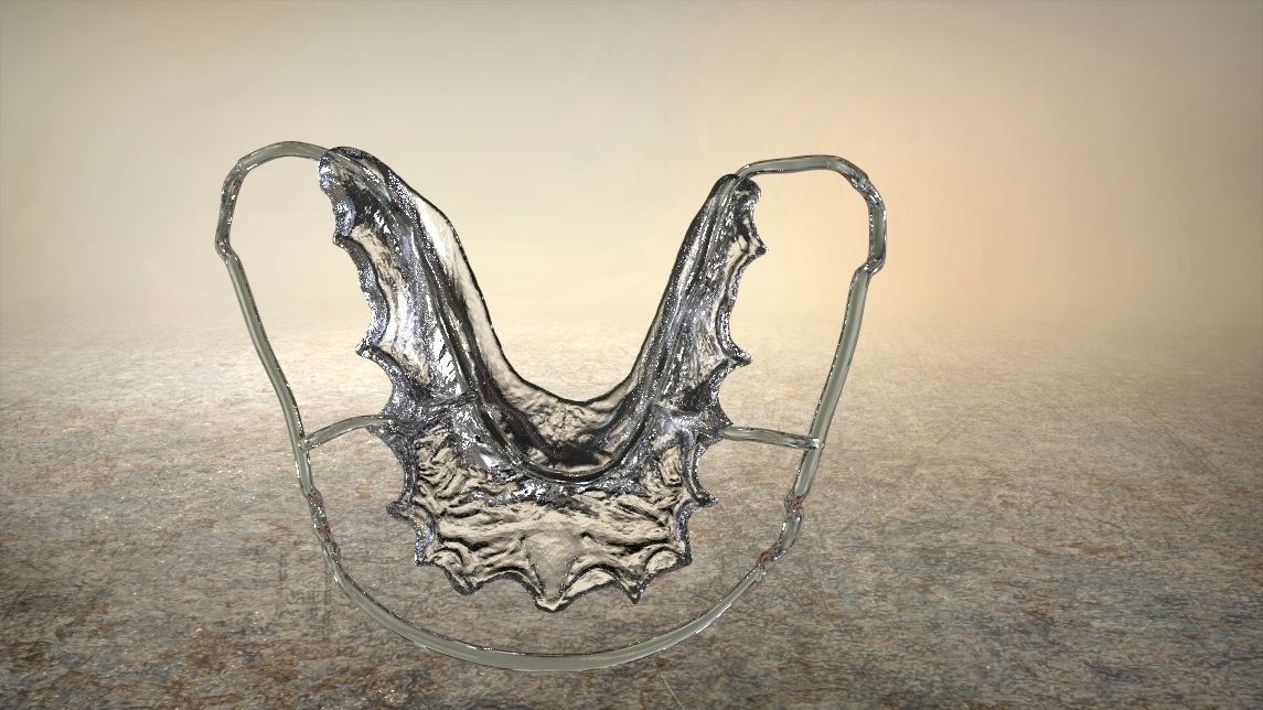 Digital Circumferential Wrap-around Retainer 3D print model_6