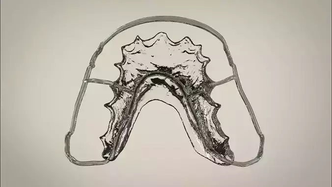 Digital Circumferential Wrap-around Retainer 3D print model