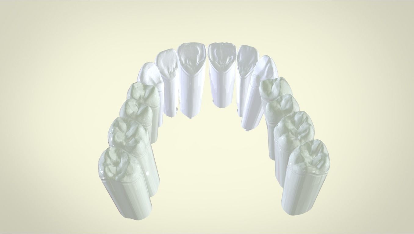 Digital Dental Unsectioned and Sectioned Model 3D print model_3