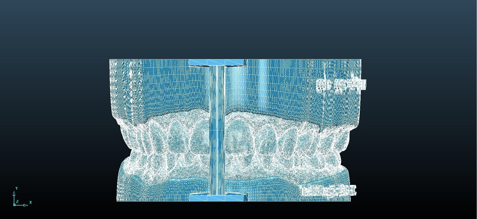 Digital Dental Unsectioned and Sectioned Model 3D print model_10