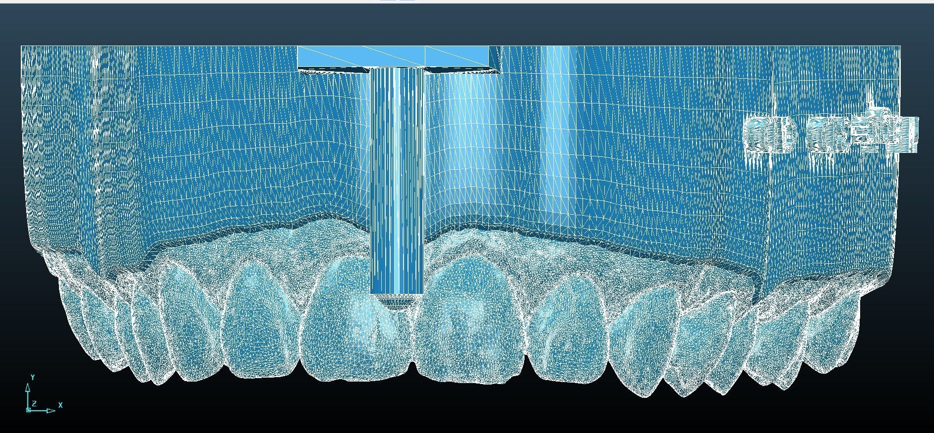 Digital Dental Unsectioned and Sectioned Model 3D print model_9