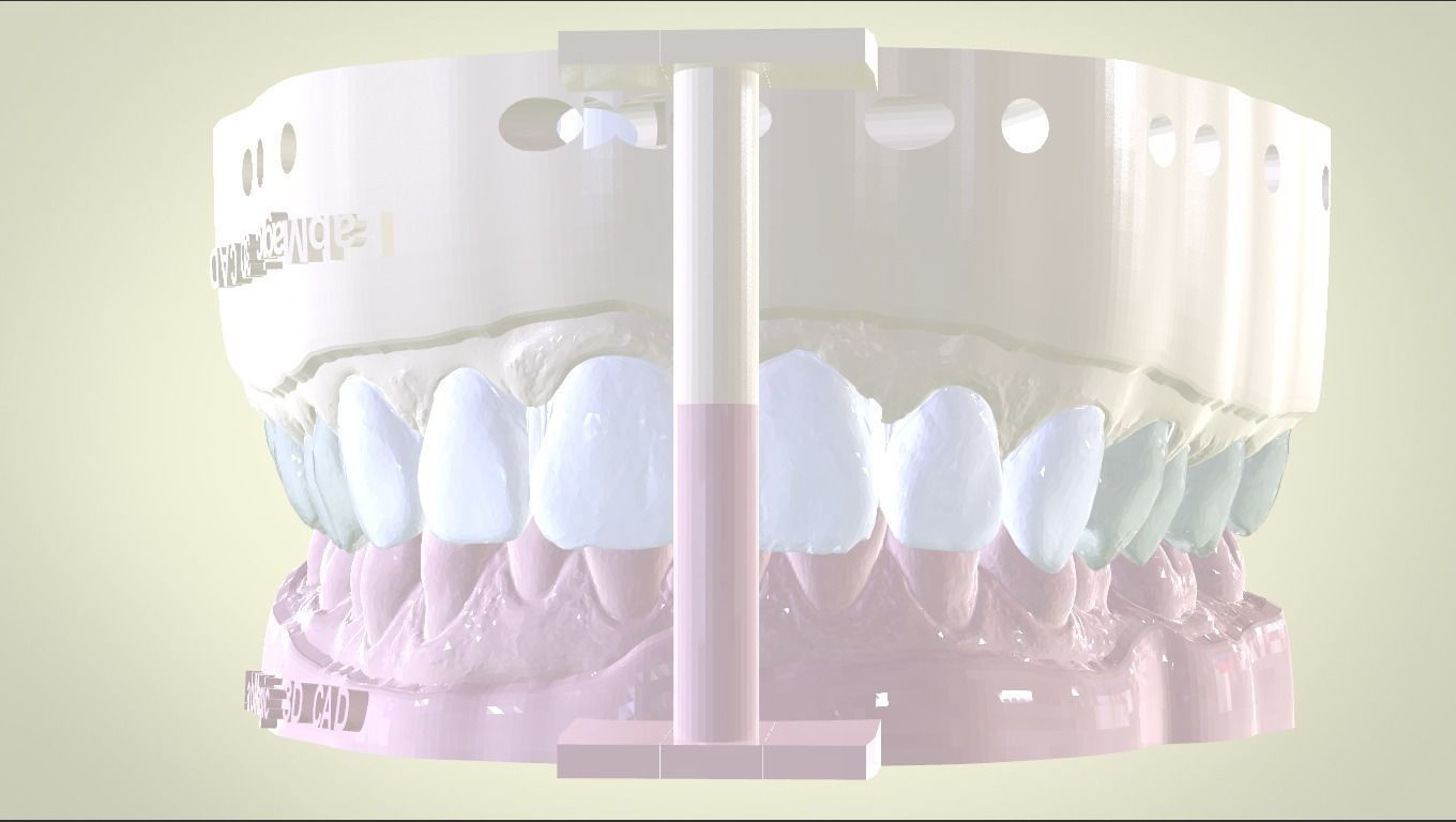 Digital Dental Unsectioned and Sectioned Model 3D print model_5