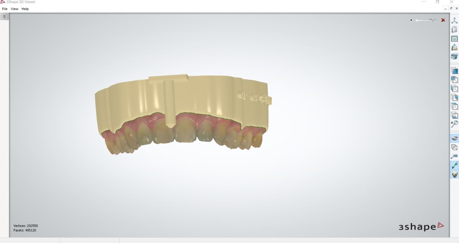 Digital Dental Unsectioned and Sectioned Model 3D print model_11
