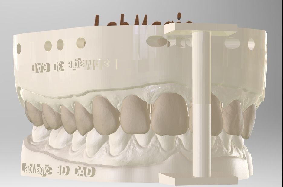 Digital Dental Unsectioned and Sectioned Model 3D print model_2