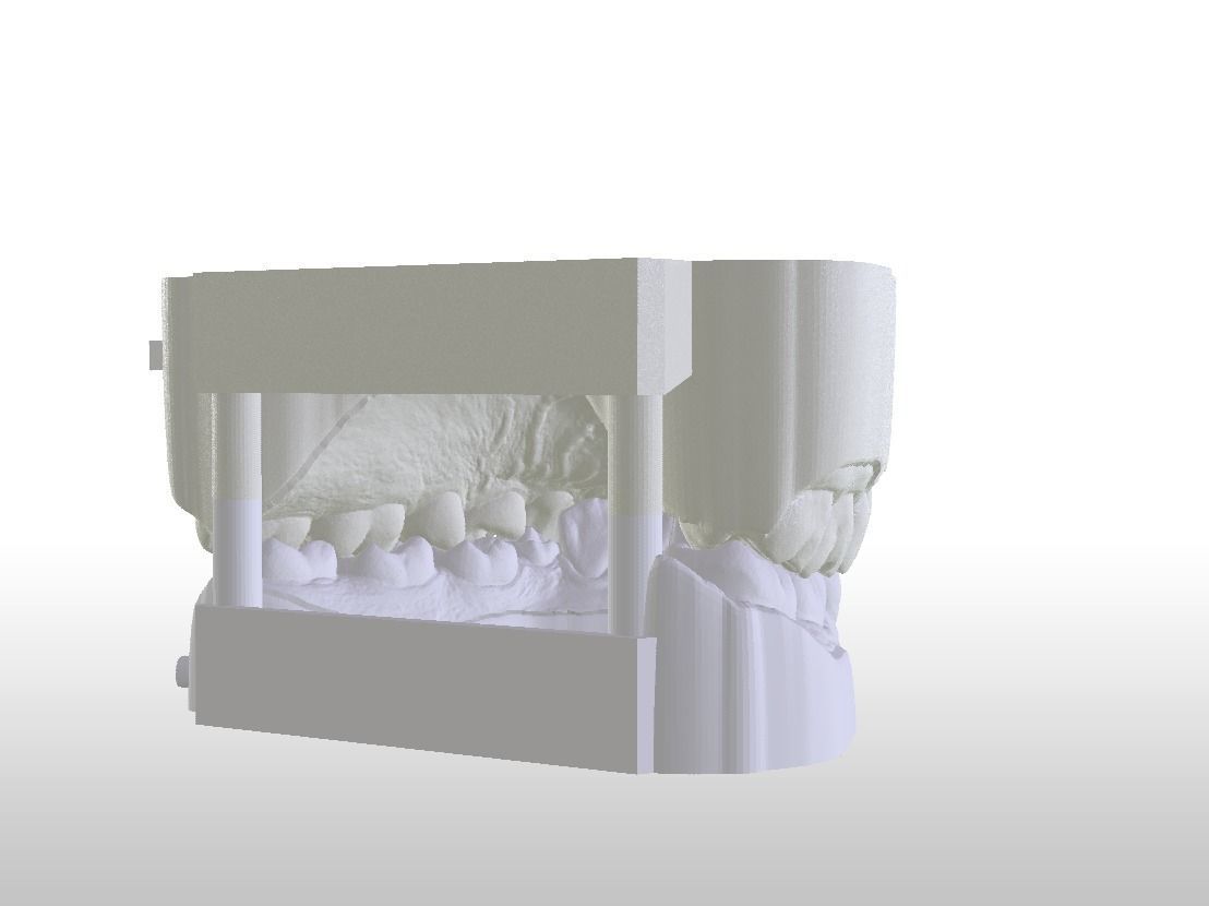 Digital Dental Unsectioned and Sectioned Model 3D print model_16