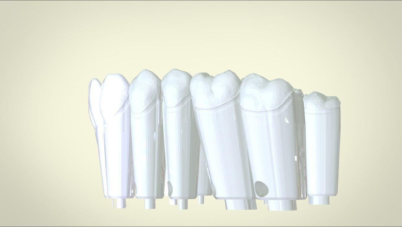 Digital Dental Unsectioned and Sectioned Model 3D print model_4