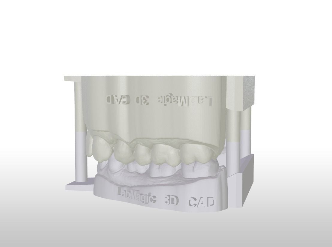 Digital Dental Unsectioned and Sectioned Model 3D print model_8