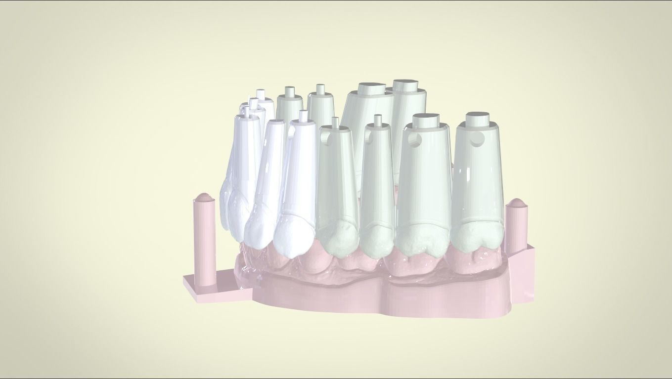 Digital Dental Unsectioned and Sectioned Model 3D print model_7