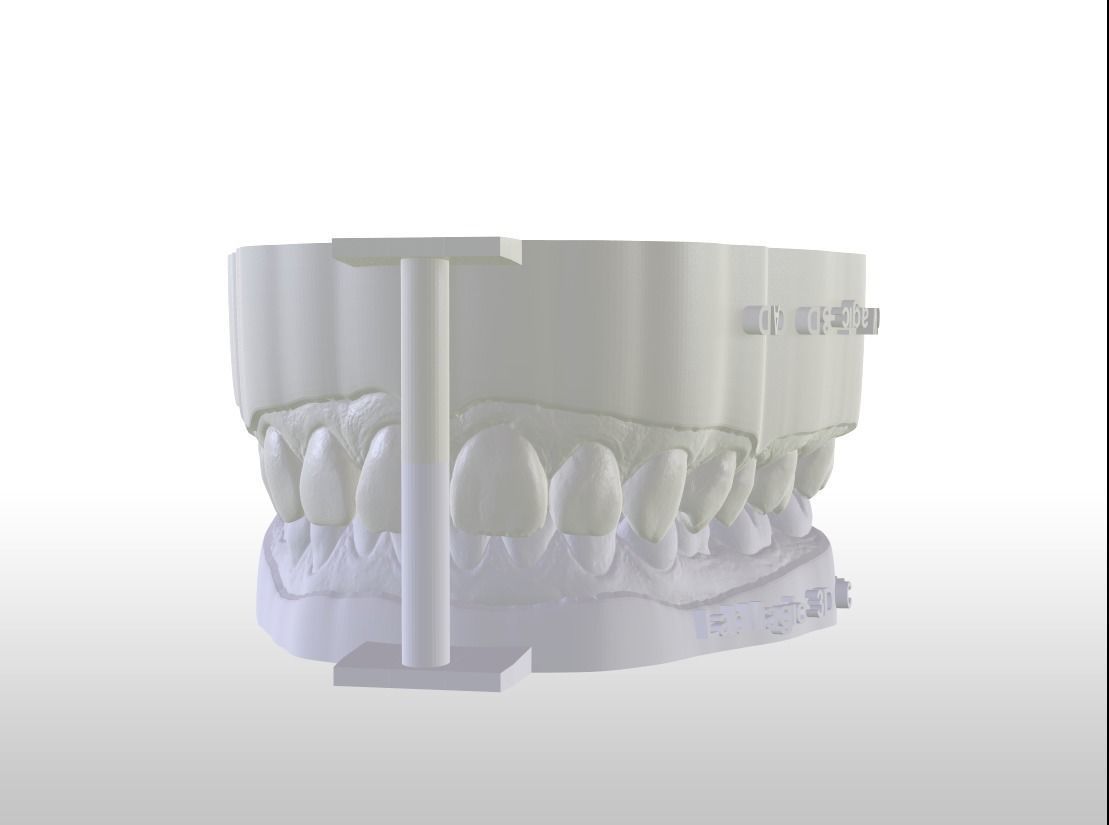 Digital Dental Unsectioned and Sectioned Model 3D print model_14