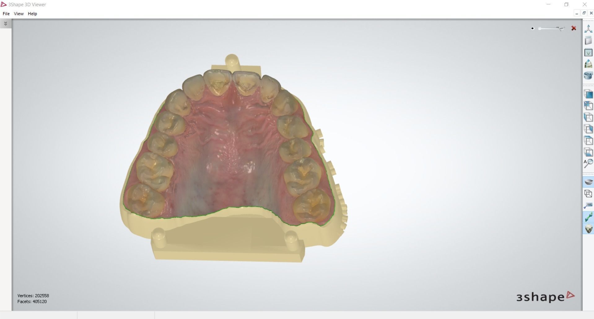 Digital Dental Unsectioned and Sectioned Model 3D print model_12