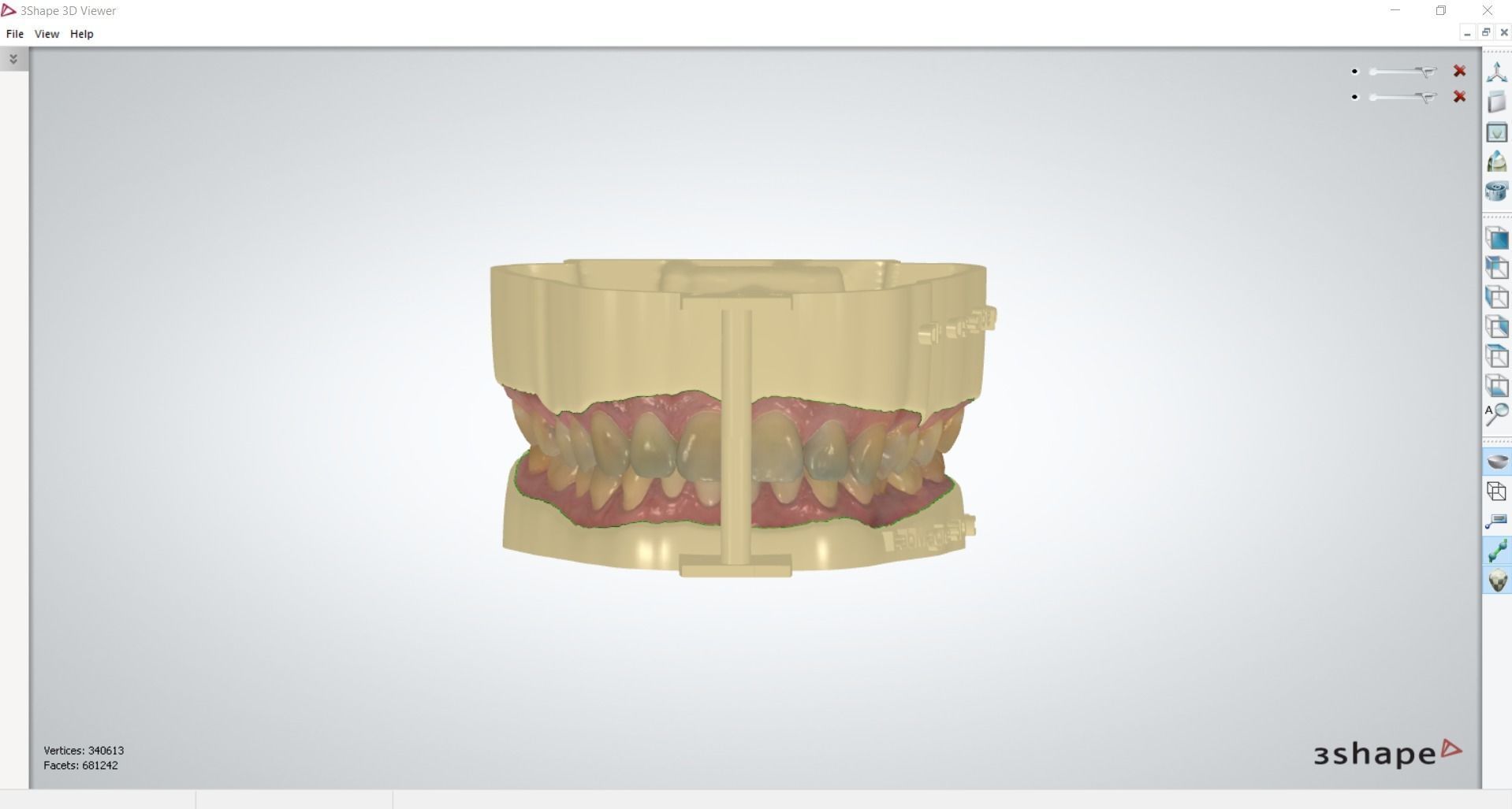 Digital Dental Unsectioned and Sectioned Model 3D print model_13