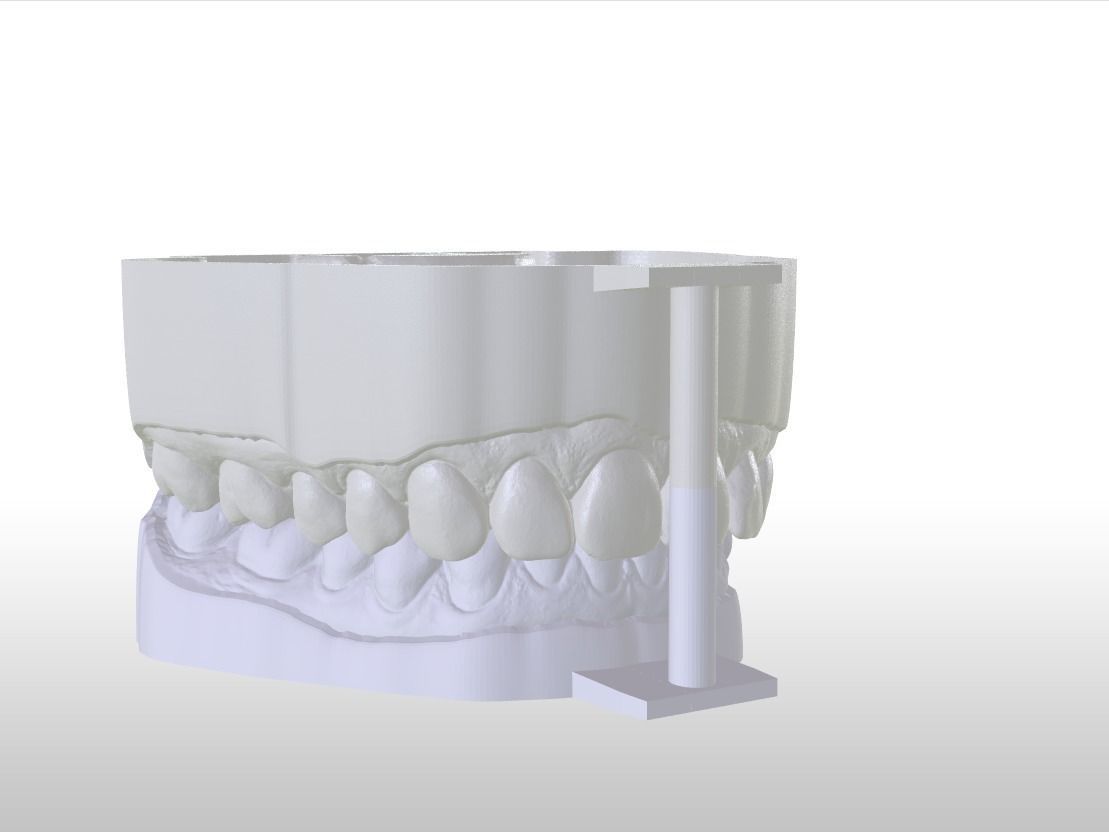 Digital Dental Unsectioned and Sectioned Model 3D print model_15