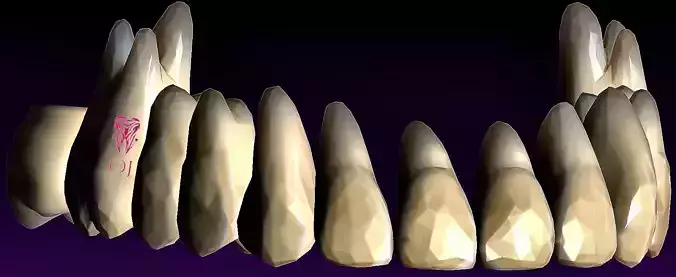 OJ Crystal Exocad library